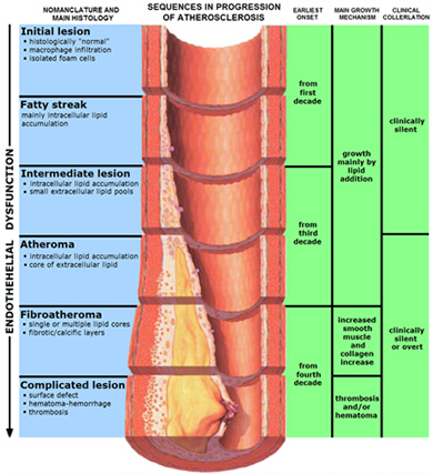 Erectile Dysfunction And Atherosclerosis