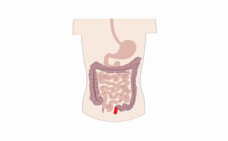 Crohn's Diet - Treat And Prevent Crohn's Disease