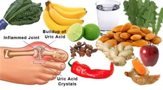 How To Get Rid Of Gout?
