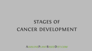 Stages Of Cancer Development