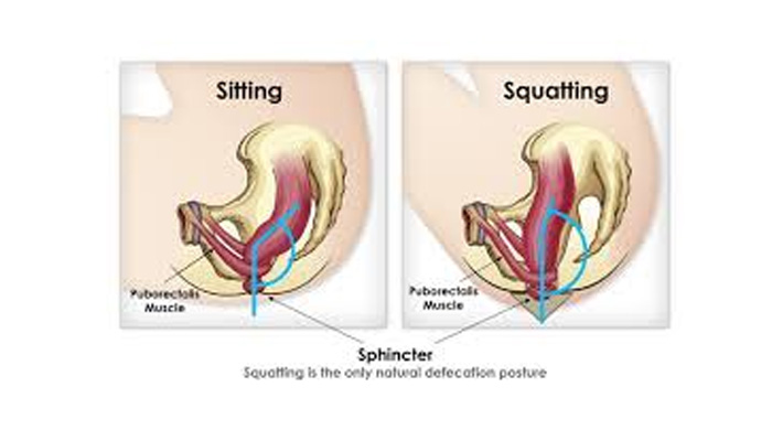 Does The Squatty Potty Work? Its All About The Pooping Position